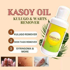 Kasoy Oil by Angel Touch – 60mL