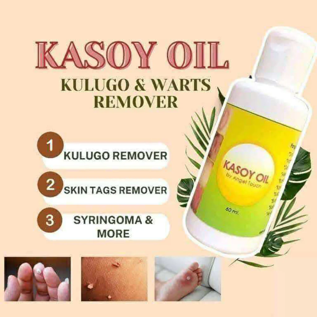 Kasoy Oil by Angel Touch – 60mL