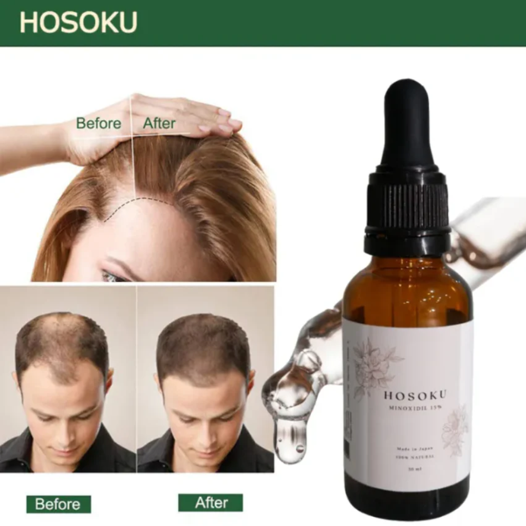 HOSOKU Minoxidil 15% Hair Regrowth Oil – 30ml