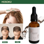HOSOKU Minoxidil 15% Hair Regrowth Oil – 30ml
