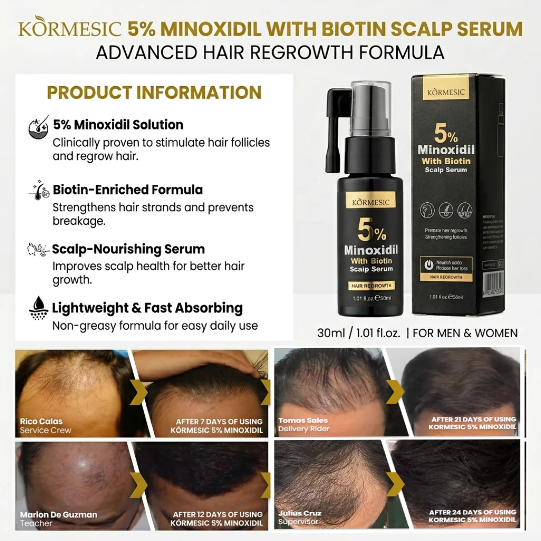KORMESIC 5% Minoxidil with Biotin Scalp Serum – 30mL