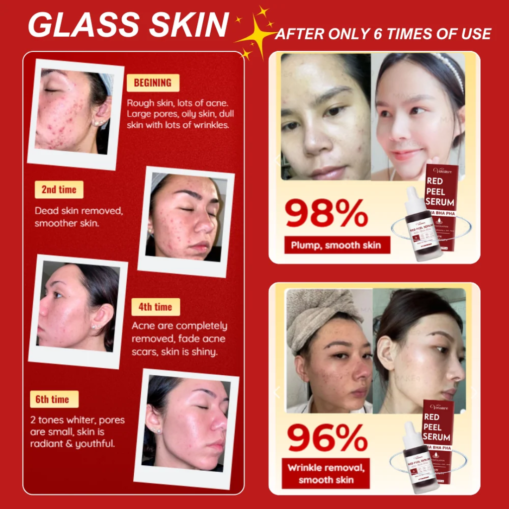 Venature Red Peel Serum - 20mL