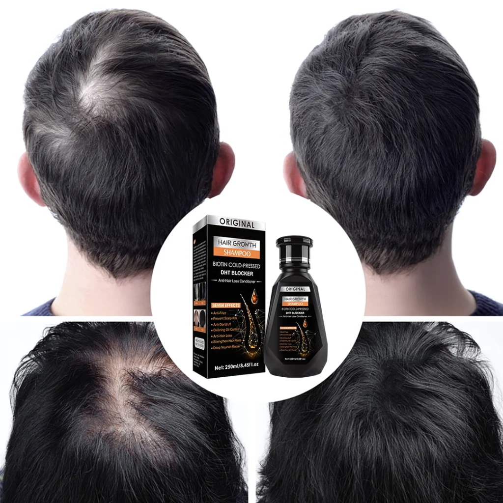 Original Biotin Cold-Pressed DHT BLOCKER Hair Growth Shampoo Formbo- 250ML