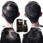 Original Biotin Cold-Pressed DHT BLOCKER Hair Growth Shampoo Formbo- 250ML