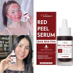 Venature Red Peel Serum - 20mL