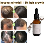 HOSOKU Minoxidil 15% Hair Regrowth Oil – 30ml